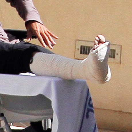 Halle Berry cast fingers.jpg Halle Berry cast fingers.jpg
